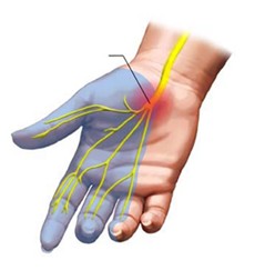 Diabetická retinopatie